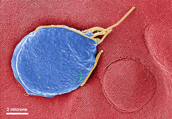 SEM depicts a Giardia muris protozoan adhering itself to the microvillous border of an intestinal epithelial cell. From Public Health Image Library (PHIL). [1]