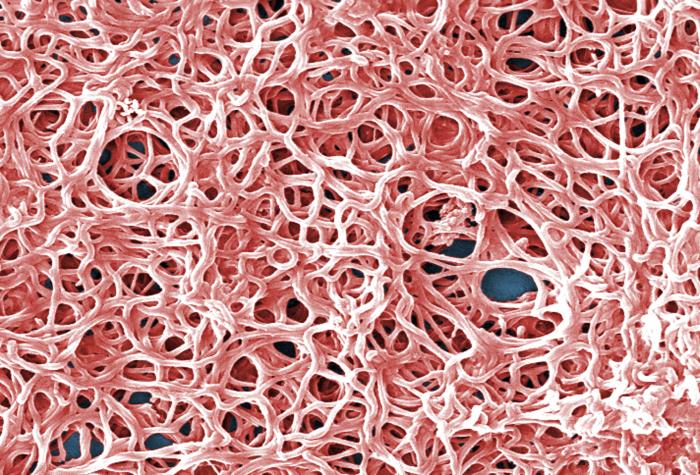 An enlarged view of PHIL 13166, this digitally-colorized scanning electron micrograph (SEM) depicts a grouping of numerous Gram-negative, anaerobic, Borrelia burgdorferi bacteria, which had been derived from a pure culture. From Public Health Image Library (PHIL). [2]