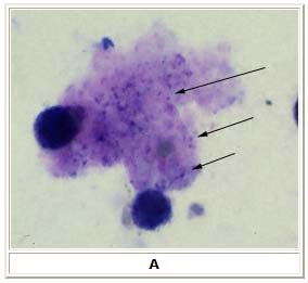 Pneumocystis jirovecii trophozoites