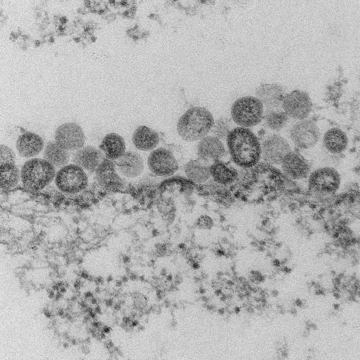 TEM reveals ultrastructural morphology of the Middle East Respiratory Syndrome Coronavirus (MERS-CoV). From Public Health Image Library (PHIL). [16]