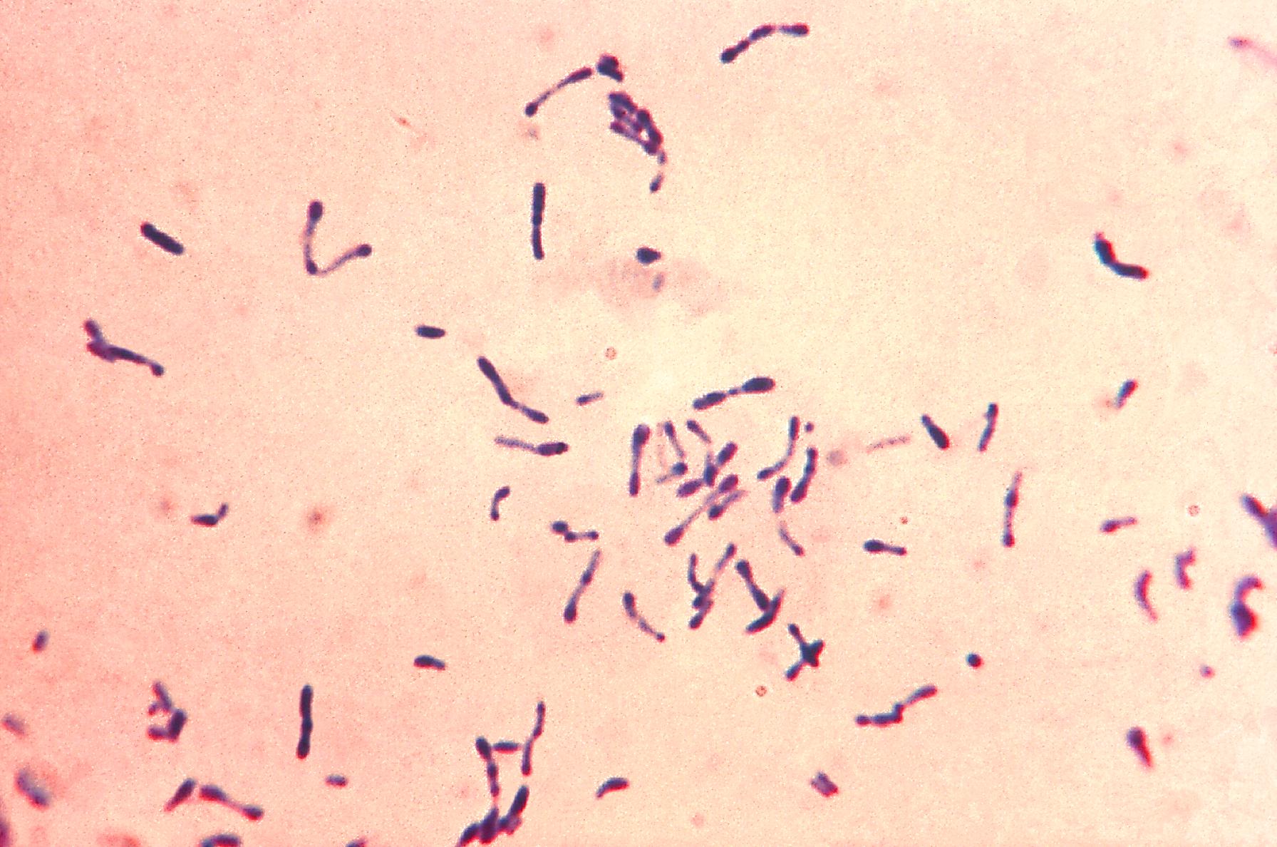 Gram stained Corynebacterium diphtheriae culture