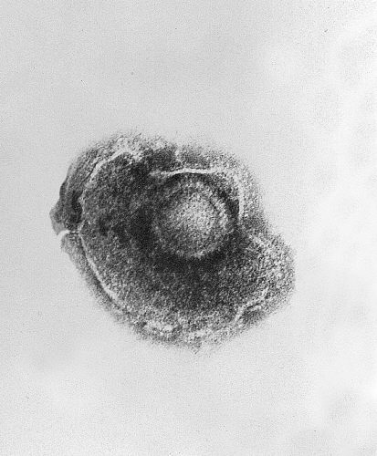 Transmission electron micrograph (TEM) of a Varicella (Chickenpox) Virus. From Public Health Image Library (PHIL). [8]