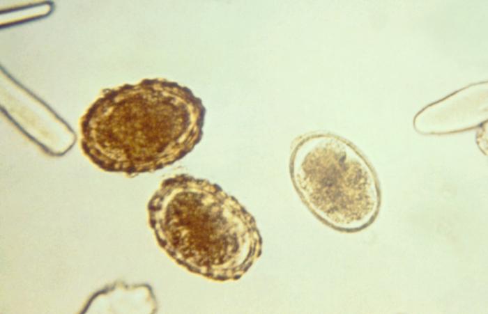 These are 3 fertilized A. lumbricoides eggs with the one on the right being decorticated, for its outer layer is absent. From Public Health Image Library (PHIL). [2]