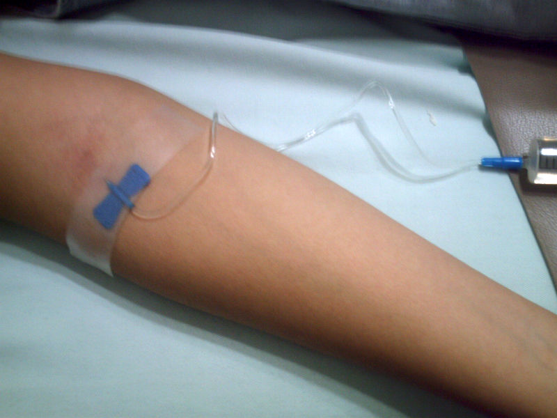 A patient receiving an intravenous infusion.