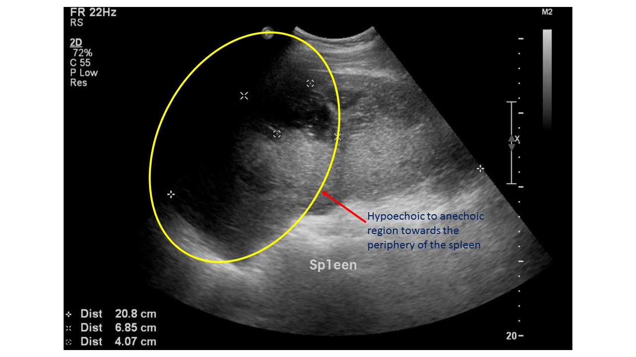 File:Splenic abscess ultrasound.jpg