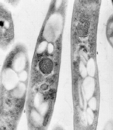"Transmission electron micrograph of Bacillus anthracis.”Adapted from Public Health Image Library (PHIL), Centers for Disease Control and Prevention.[21]