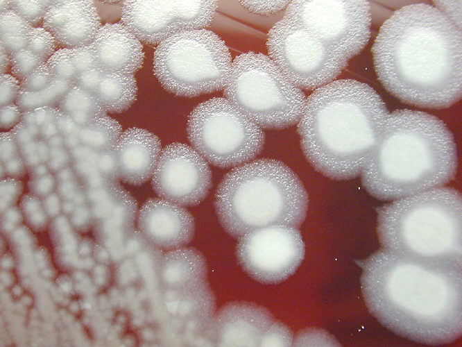 "Bacillus anthracis Avirulent Pasteur Strain, Non-hemolytic on sheep blood agar” Adapted from Public Health Image Library (PHIL), Centers for Disease Control and Prevention.[20]