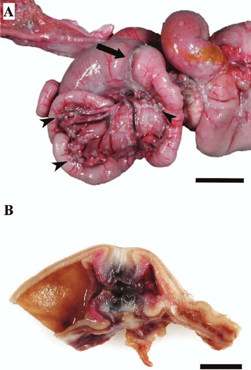 File:Macroscopic-appearance-of-small-intestinal-adenocarcinoma-with-carcinomatosis-in-the.jpg